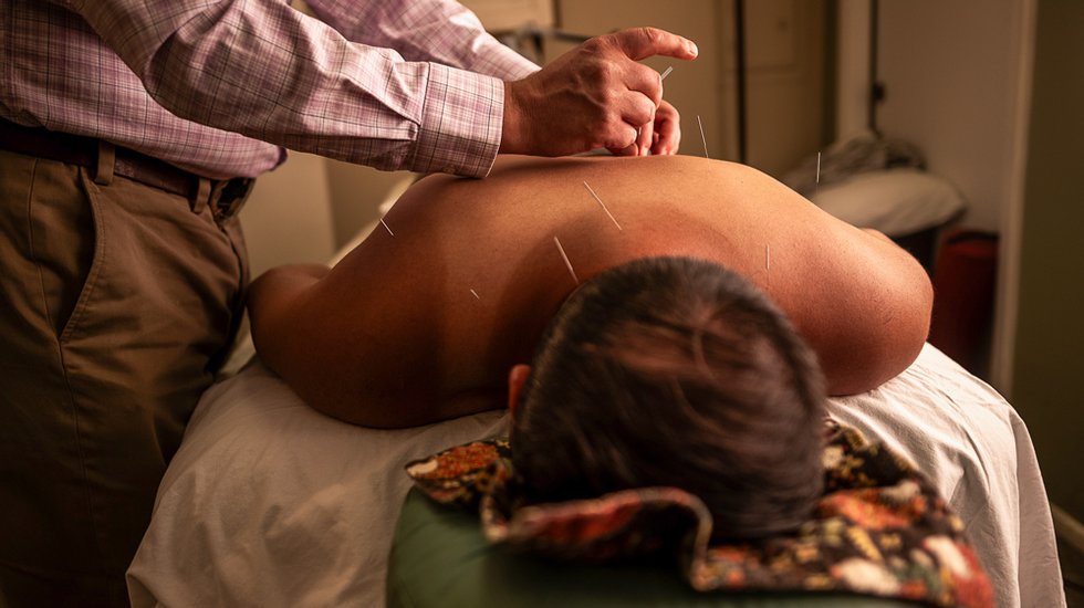 6-Health-MAIN-Acupuncture.jpg